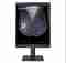 LG medical monitor 21HQ613D 21